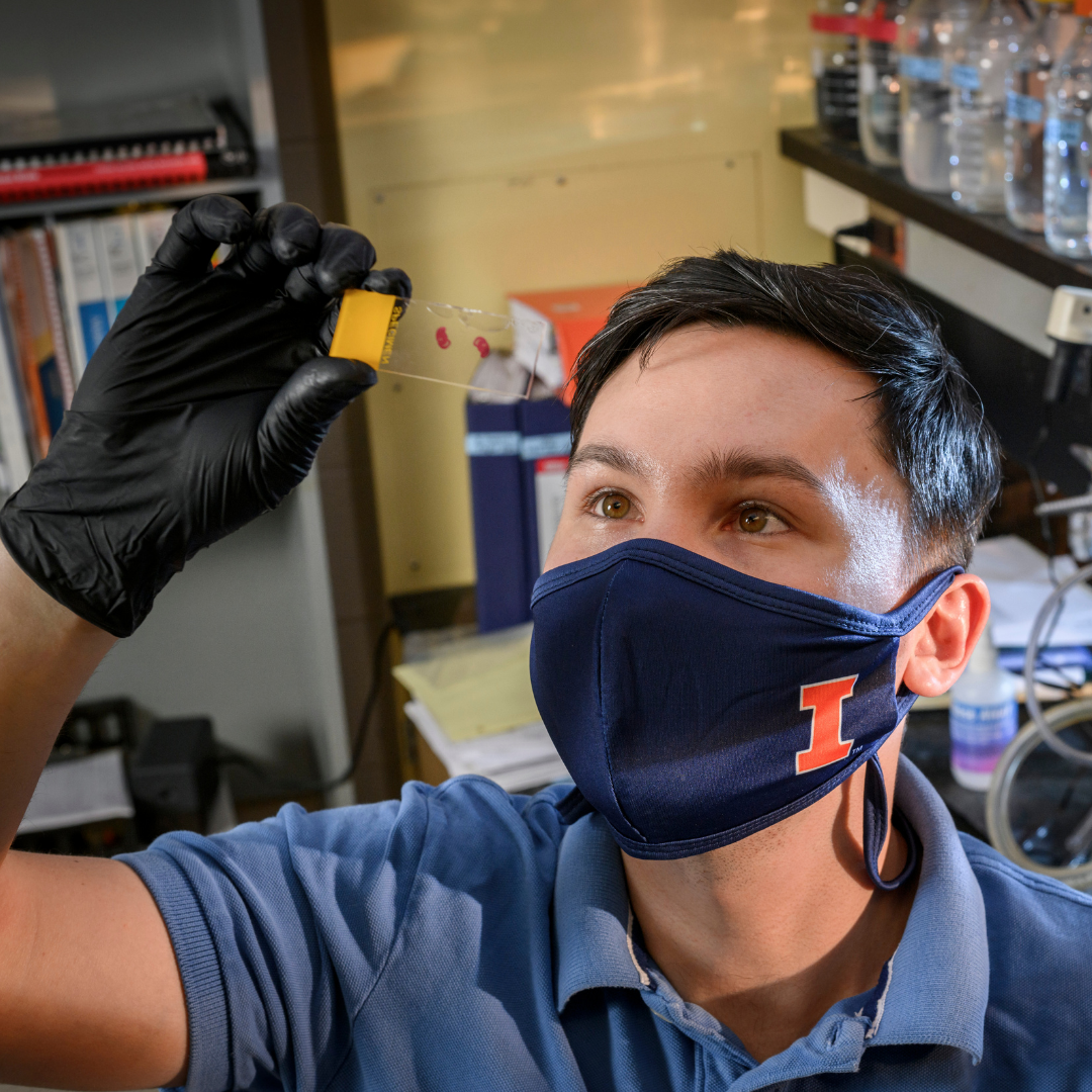 PhD student Temirlan Shilikbay, wearing a U of I mask, holds up a slide and observes it.