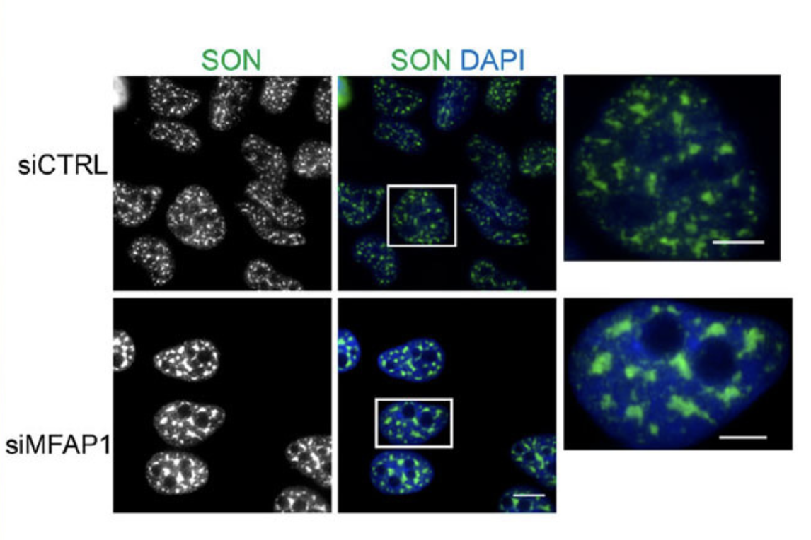 Levels of MFAP1, newly identified as a protein enriched in nuclear speckles in this article, modulate nuclear speckle size, with knockdown of MFAP1 levels resulting in an increase in nuclear speckle size. Top row shows immunostaining of nuclear speckles using an antibody against the known nuclear speckle marker, SON (green) and DNA staining using DAPI (blue) in control cells. Bottom row shows the same after reduction of MFAP1 levels using RNAi with siRNAs homologous to MFAP1.