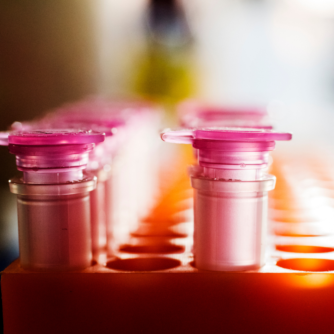 Photo of two rows of pink test tubes in an orange test tube holder.