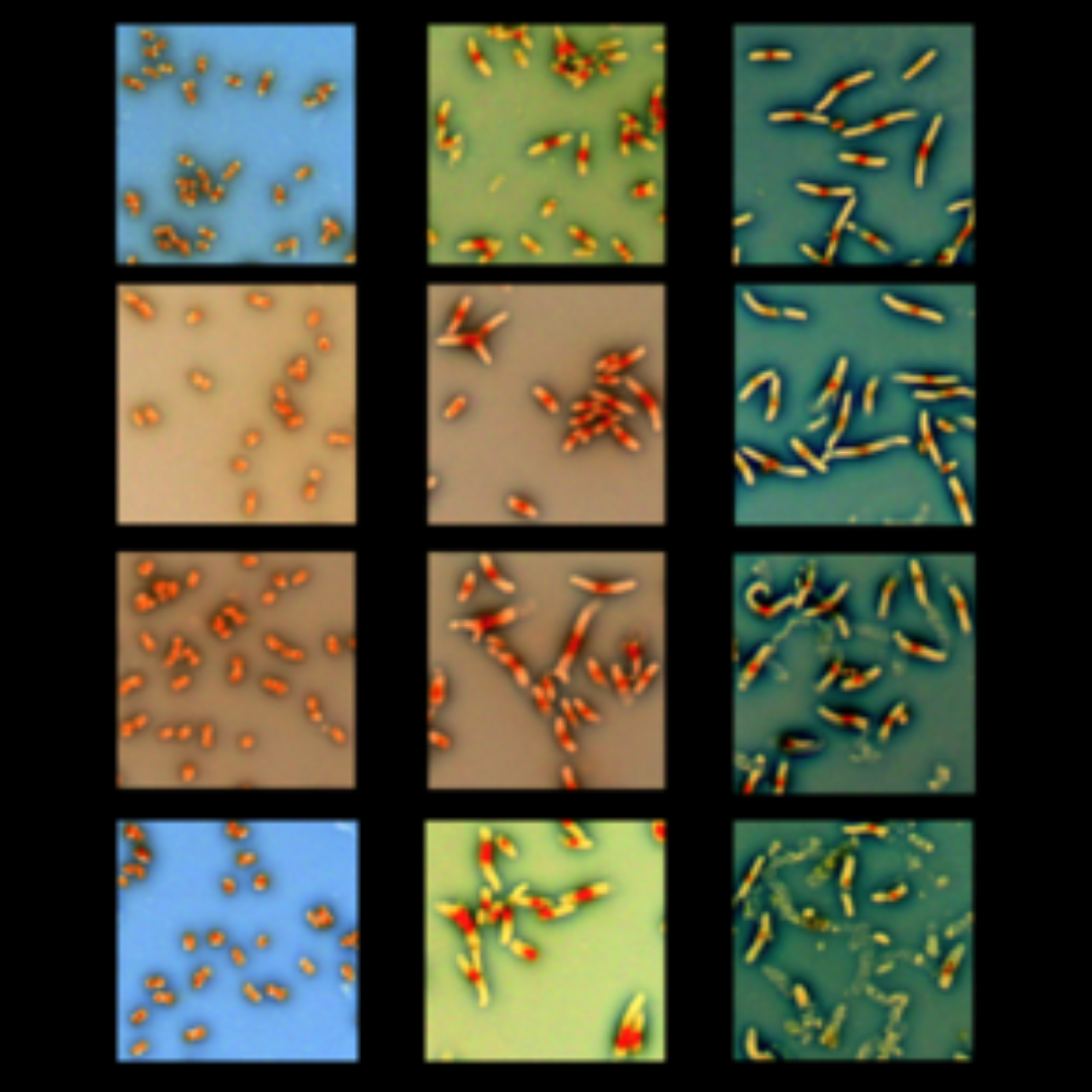 An inverted image of DAPI-stained thyA mutant E. coli with additional defects in the enterobacterial common antigen biosynthesis under thymine starvation started by removal of thymidine from their growth medium. Left column: cells still grown in the presence of thymidine. Central column: one hour without thymidine. Right column: three hours without thymidine. Cells in the bottom row undergo massive lysis.