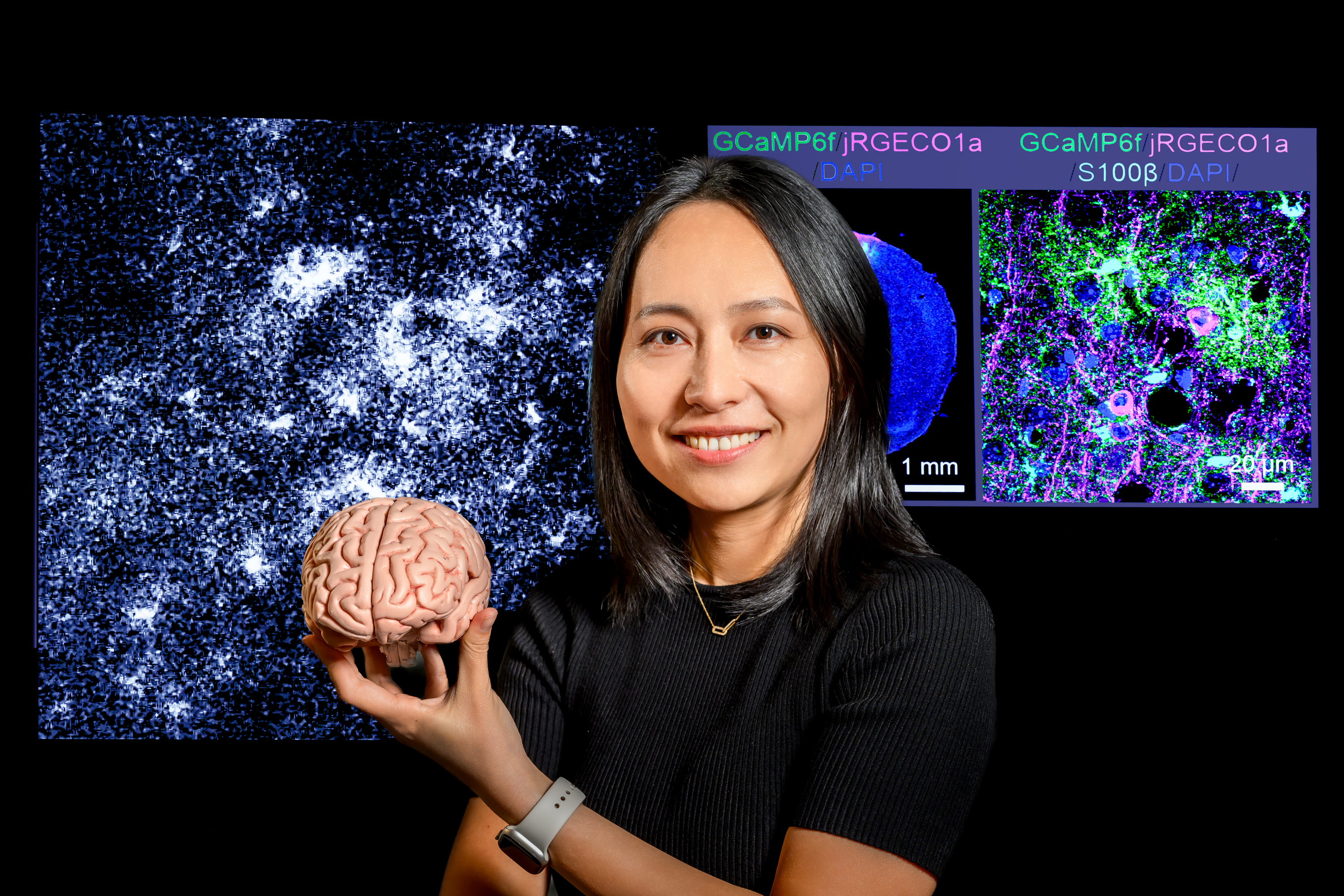 Xinzhu Yu holds a model of a brain