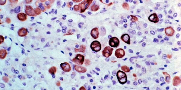 pituitary gland