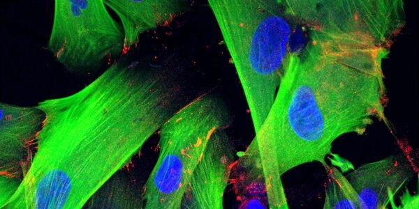 Stained microscopy image of human fibroblast cells showing the cytoskeleton in green, cell-cell contact proteins in red and the nucleus in blue 