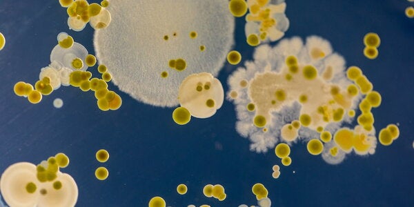 bacteria on a Petri dish