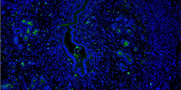  uterine stromal cells  