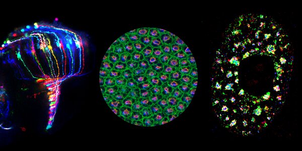 collage of research images, including nuclear speckles, related to cell and developmental biology