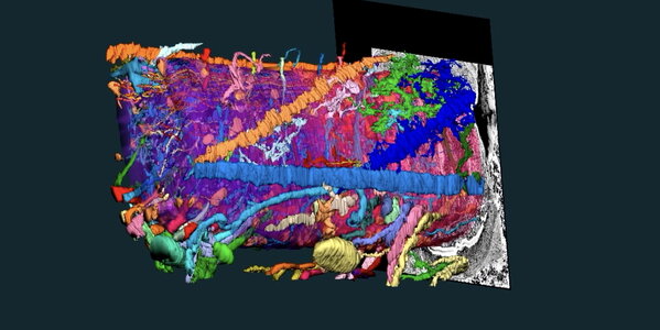 electron microscopy displaying the matrix of neural circuitry, muscles, blood vessels and other tissues in the octopus arm