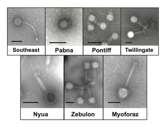 Two rows of images - Staphylococcus phages discovered in Tuscaloosa, AL. Scale bar = 100 nm