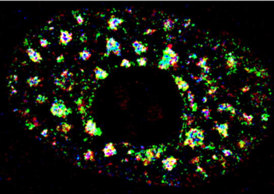 super-resolution imaging data of MALAT1, U2snRNA and splicing factors within the nuclear speckles.