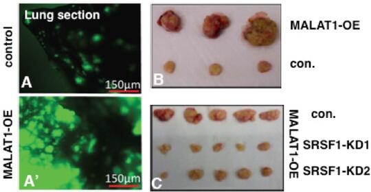 Fig. 2: MALAT1 displays oncogene activity. (A) Increased lung colonization of MALAT1 overexpressed (OE) GFP +ve cells in xenograft model (Jadaliha et al., 2016). (B) MALAT1-overexpressed cells show enhanced tumor growth. (C) SRSF1 depletion (KD) reduces MALAT1-induced tumor growth in cancer cells (Malakar et al., 2017).