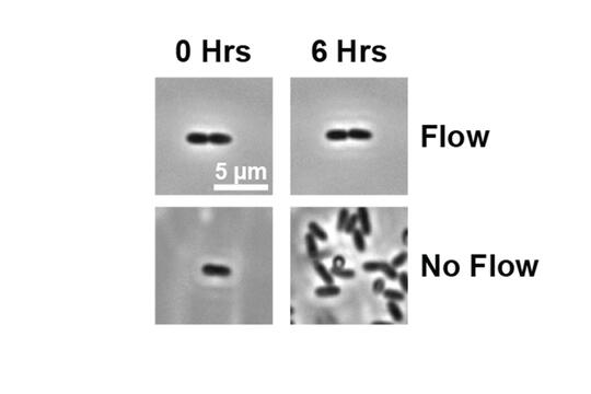 Microscope images when antibiotics were first administered and six hours later, with and without fluid flow. The researchers hope that testing samples under flow conditions can improve antibiotic screening and development. 