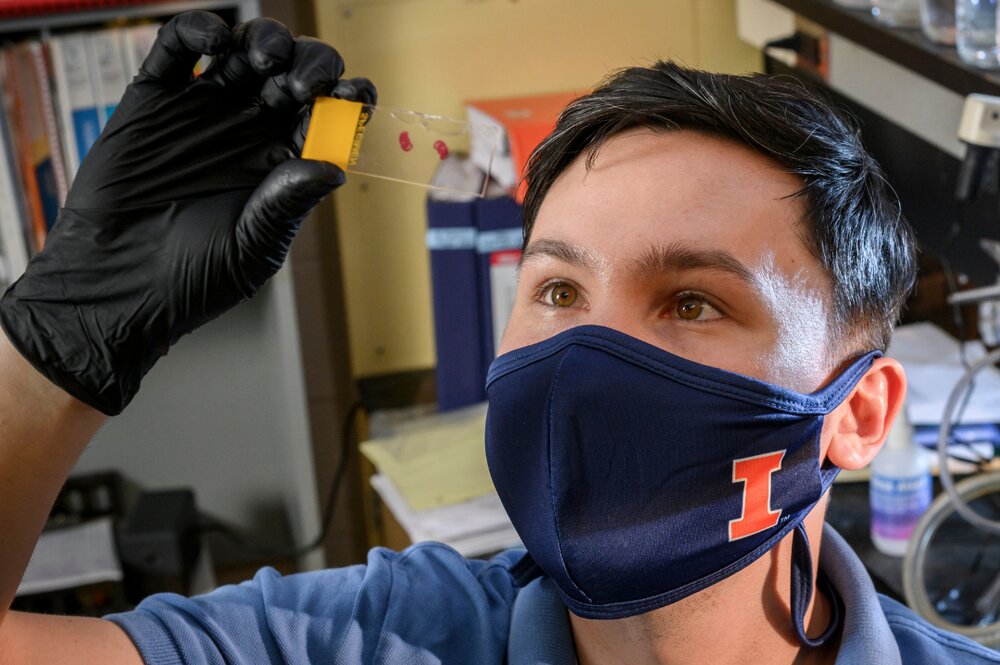 PhD student Temirlan Shilikbay, wearing a U of I mask, holds up a slide and observes it.