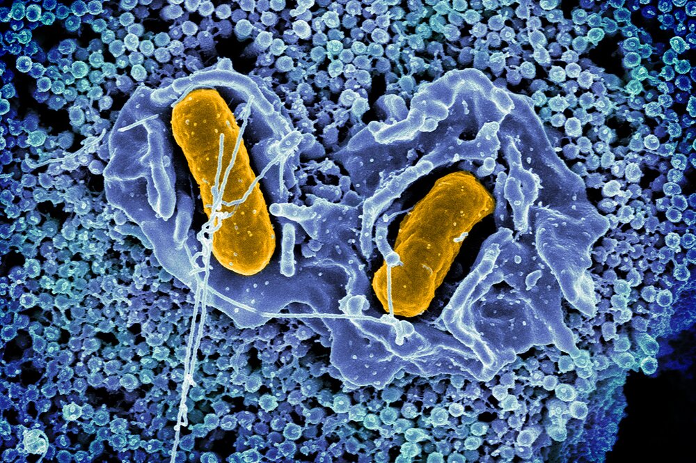 Scanning electron micrograph of Salmonella typhimurium invading a human epithelial cell.