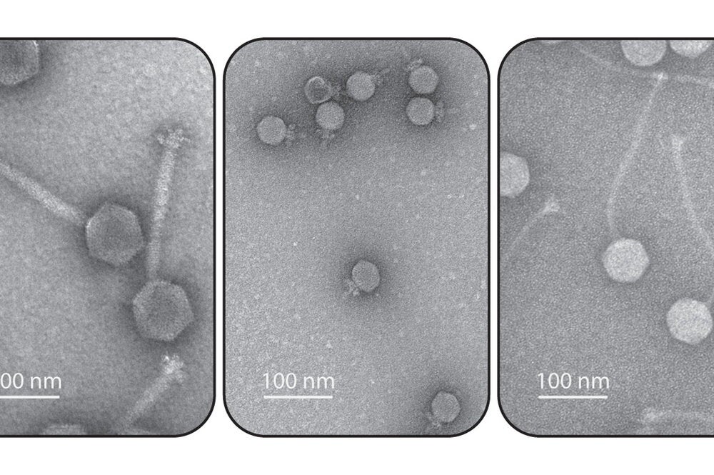 Electron micrographs of bacterial viruses