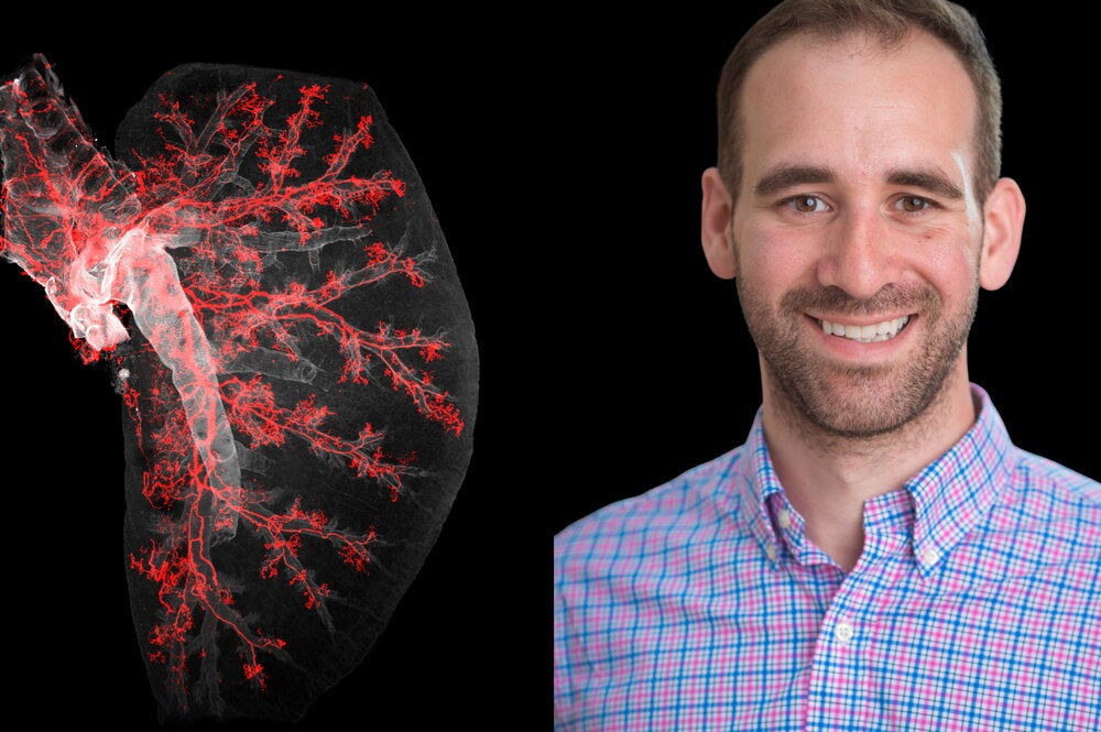 image of mouse lung and headshot of man in blue and pink checked shirt