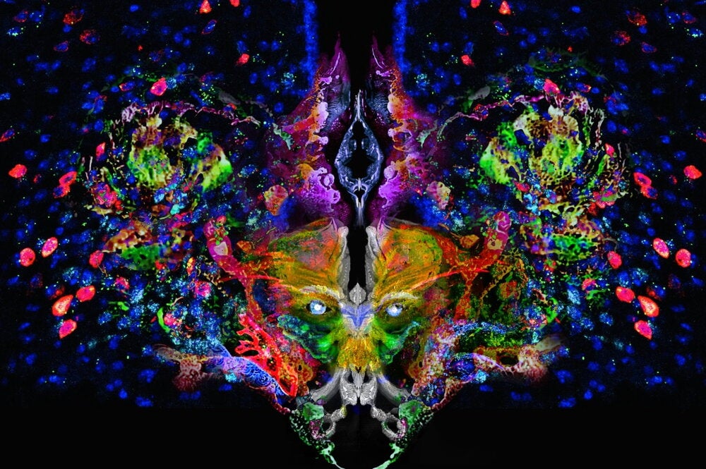 RNAscope confocal images of mouse brain with watercolor textures photographed and digitally layered into a single composition