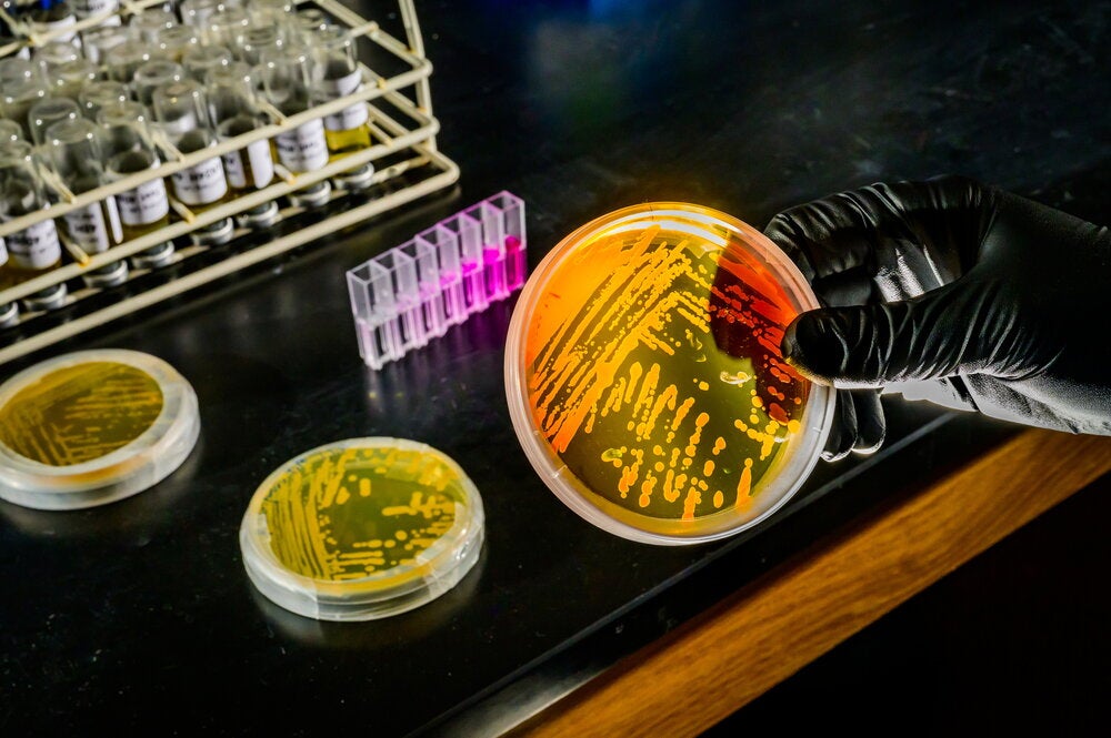 Three petri dishes on a lab bench