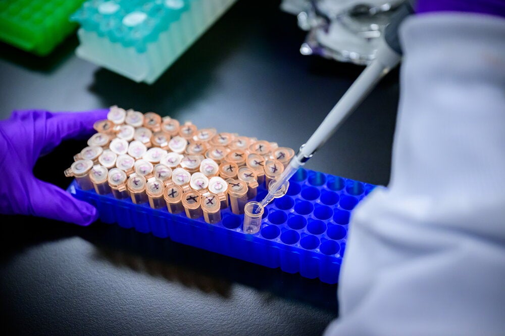 Hand using a pipette 