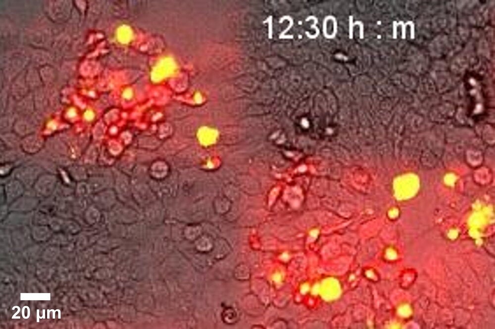 Microscopic image of optogenetics killing cancer cells