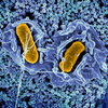 Scanning electron micrograph of Salmonella typhimurium invading a human epithelial cell.