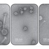Electron micrographs of bacterial viruses