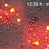 Microscopic image of optogenetics killing cancer cells