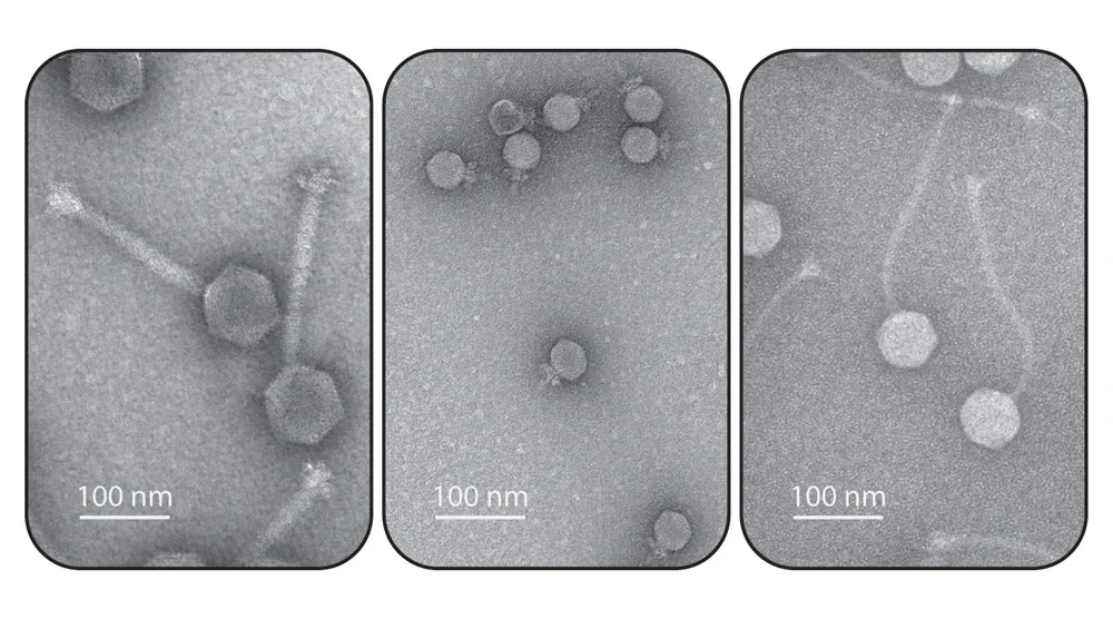 Electron micrographs of bacterial viruses