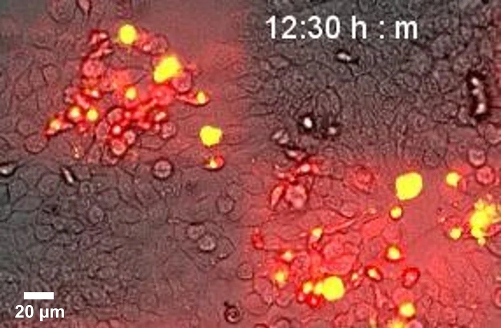 Microscopic image of optogenetics killing cancer cells